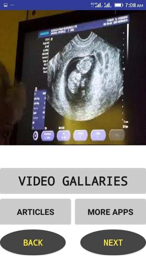 Ultrasound Video स्क्रीनशॉट 2