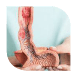 ikon How to Treat Ulcers