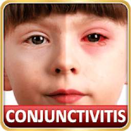 Help for Baby Conjunctivitis & Pinkeye in Children
