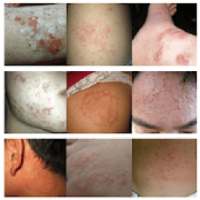 All Skin Infections & Treatments on 9Apps