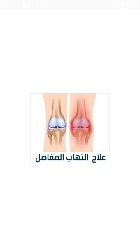 علاج ألم المفاصل بالأعشاب
‎ 3 تصوير الشاشة