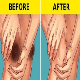 تفتيح المناطق الداكنة (ركب-مرفق-رقبة-مناطق حساسة)
‎ icon