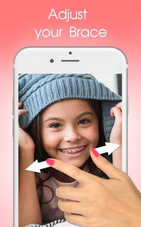 Behel Gigi - Braces Camera screenshot 1