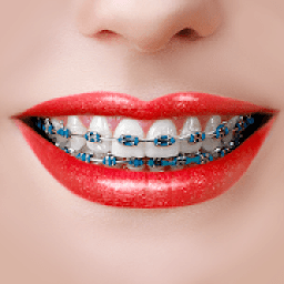 ikon Behel Gigi - Braces Camera