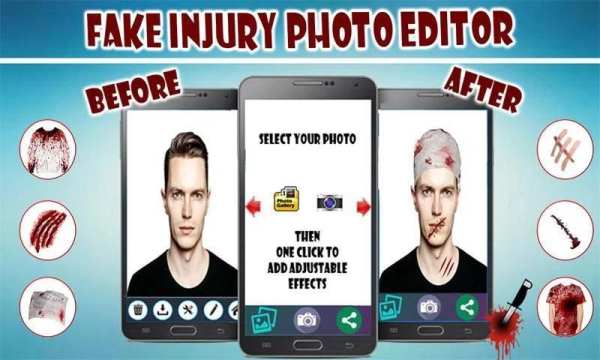 Fake Injuries Photo Editor 2019-Injury Marks Maker स्क्रीनशॉट 1