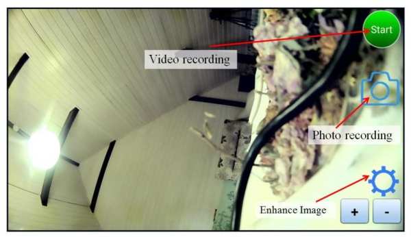 new Chinese Endoscope screenshot 4
