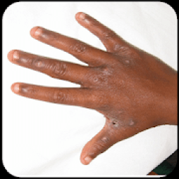 চর্মরোগ ও প্রতিকার icon