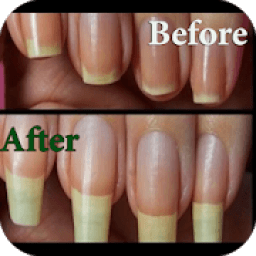 ikon تطويل الاظافر بسرعه
‎