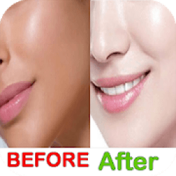 تفتيح البشرة بسرعة
‎ icon