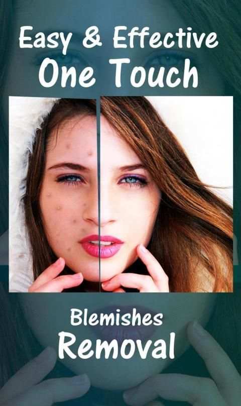 Face Blemishes Cleaner & Photo Scars Remover screenshot 9