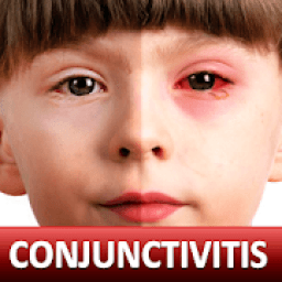 ikon Help for Baby Conjunctivitis &amp; Pinkeye in Children