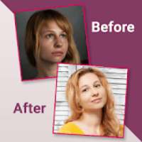 Before After Photo Collage - Compare Old Photos on 9Apps