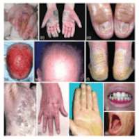 All Skin Diseases Atlas & Treatments on 9Apps