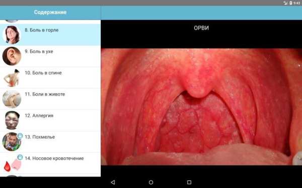 Первая помощь - Карманный доктор (базовая версия) screenshot 4