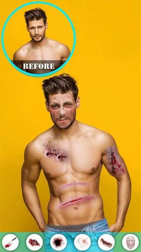 Injury Photo Editor screenshot 1