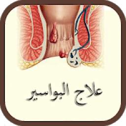علاج البواسير 2.3