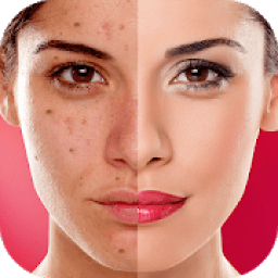 ikon Face Blemishes Cleaner &amp; Photo Scars Remover