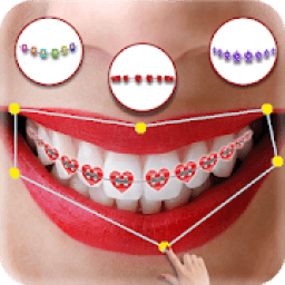 Real Braces Camera आइकन