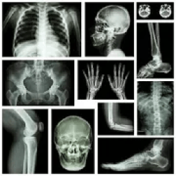 ikon musculoskeletal x-ray interpretation GUIDE