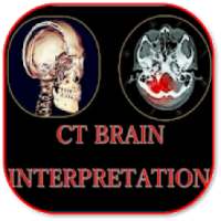 CT Brain Basic Interpretation