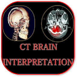 ikon CT Brain Basic Interpretation