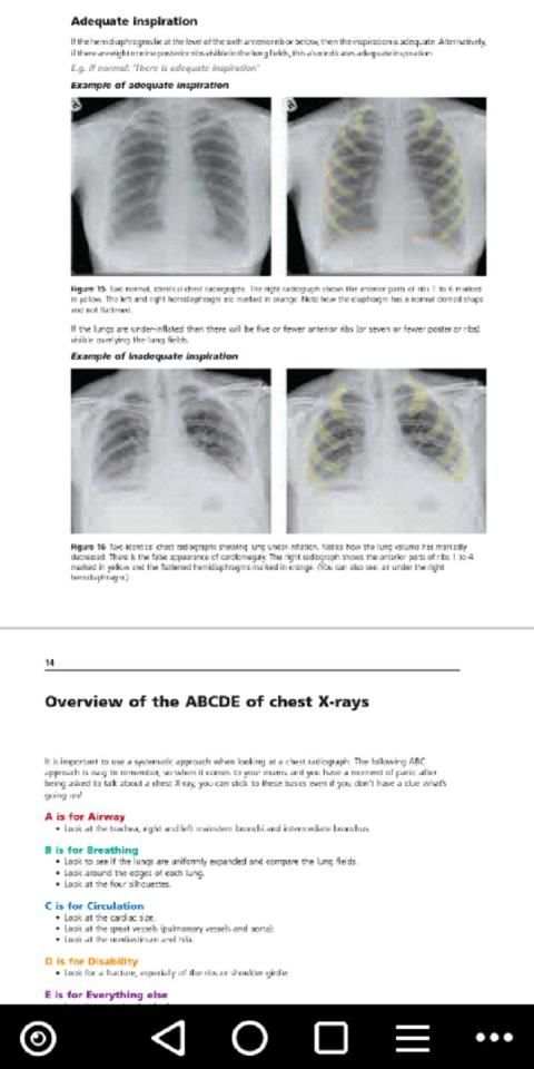 Chest X Ray Interpretation for Medical Students screenshot 1