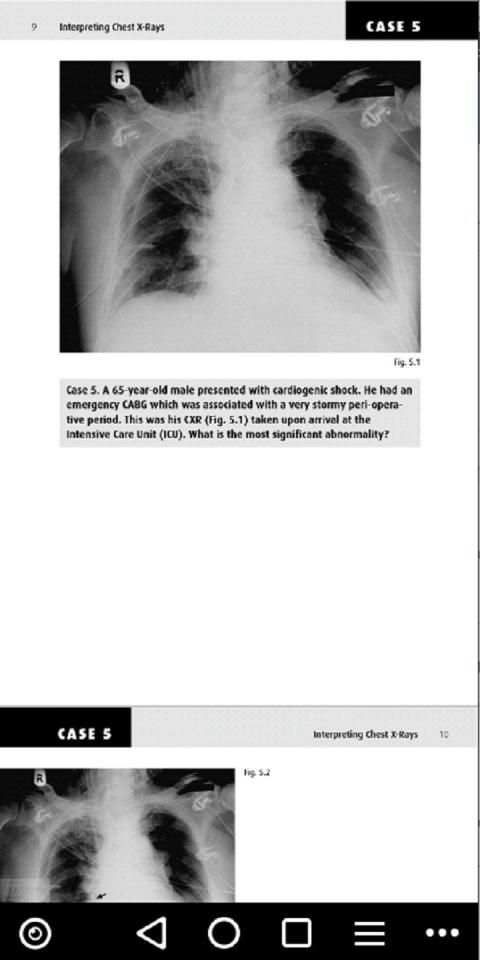 Chest X Ray Interpretation for Medical Students screenshot 2