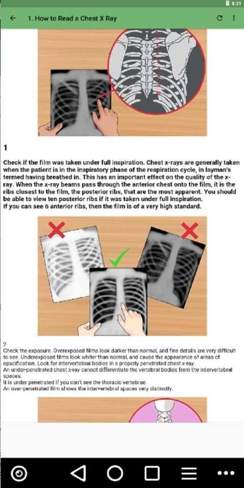 Chest X Ray Interpretation for Medical Students screenshot 3