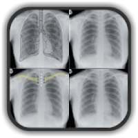 Chest X Ray Interpretation for Medical Students