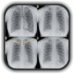 ikon Chest X Ray Interpretation for Medical Students
