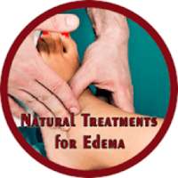 Natural Treatments for Edema on 9Apps