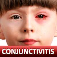 Help for Baby Conjunctivitis & Pinkeye in Children
