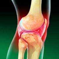 Cure joint pain!