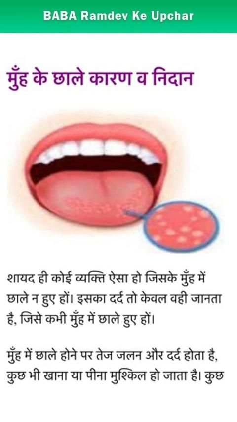 Ayurvedic Upchar स्क्रीनशॉट 3