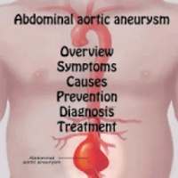 My Doctor - Abdominal Aortic Aneurysm Treatment
