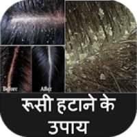 Dandruff Hatane Ke Upay on 9Apps