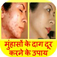 Pimple Marks Removal in Hindi on 9Apps