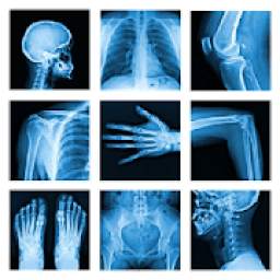X-Ray -Medical XRay Interpretation with 100+ Cases