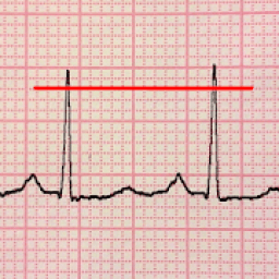 ECG Reader free आइकन