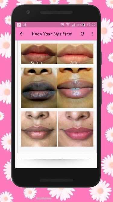 How To Get Soft Pink Lips Naturally - Lip Care स्क्रीनशॉट 4