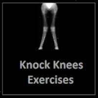 Knock Knees Exercises on 9Apps