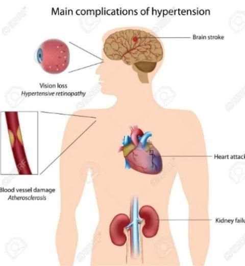 High Blood Pressure tips screenshot 1