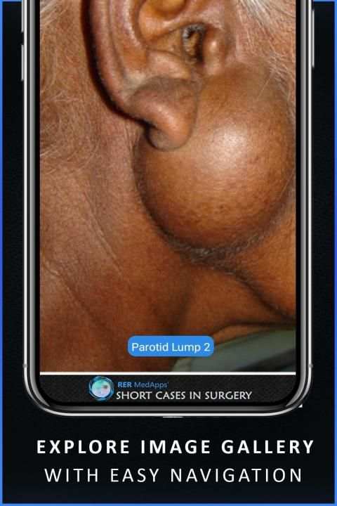 Short Cases in Surgery - OSCE for Medical Doctors screenshot 3