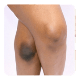 Bleaching the knees guide आइकन