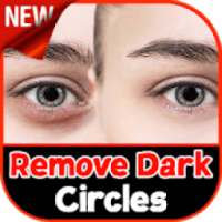 Dark Circles: Remove Dark Circles