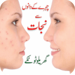 ikon Face Pimples Home Remedy Solutions – Urdu Tips